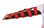 Adult Arm Splint